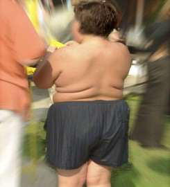 Obezitate infantila Obezitate infantila